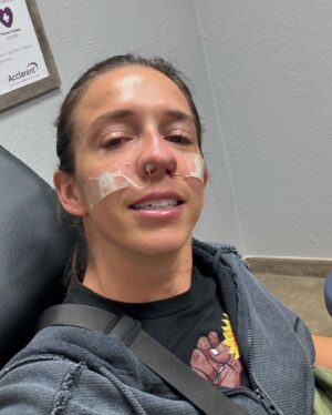 Rachel Ballinger Instagram - The stages of my nose surgery over the last 3 days. Y’all it was a JOURNEY! But we are over the biggest hump and easy breathing is in the near future! 😇☺️