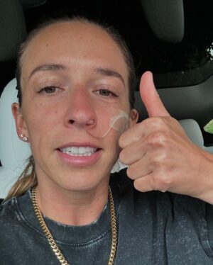 Rachel Ballinger Instagram - The stages of my nose surgery over the last 3 days. Y’all it was a JOURNEY! But we are over the biggest hump and easy breathing is in the near future! 😇☺️