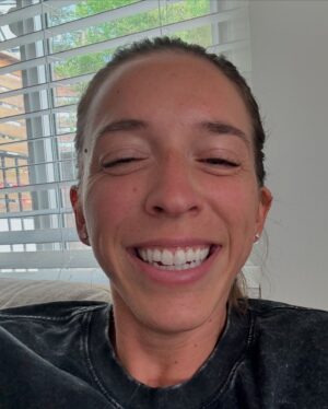 Rachel Ballinger Instagram - The stages of my nose surgery over the last 3 days. Y’all it was a JOURNEY! But we are over the biggest hump and easy breathing is in the near future! 😇☺️