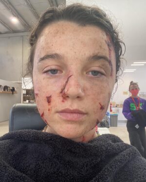 Stefania LaVie Owen Instagram - Mitzi’s magic 🪄❤️ many hours were spent in the hair and make up chair (aka the therapy chair) @mitzi_doney my hair and makeup artist 🧑🏻‍🎨🫡🙌 the hysterical laughter from sleep deprivation, the tears, the deep chats and singalongs kept me going. Love my Mitzi 🫶 @sweettoothnetflix