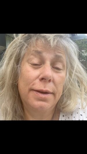 Stina Wollter Instagram - Okej, jag erkänner att en av dem jag såg var Christina Aguilera som ser ut som 15 år nu. Och jag blir så ledsen för varför kunde vi inte fått se henne åldras? Varför fick vi inte följa henne i det? Hon kunde ha rockat lika hårt. Fartblindheten in i likriktningen är skrämmande. Tonåringar börjar spara till sina första ingrepp för att slippa se ut som sig själva och 25-åringar gör samma grejer som 70-åringar. Samma läppar, samma släta pannor. Är du förvånad? Syns inte. Ledsen? Syns inte. Äsch jag känner helt enkelt sorg. Detta är ett ämne fullt av ömma tår ivägen för att komma till pudelns kärna: någon tjänar groteska pengar på att vi tror att vi måste vara något annat och tro fan det, när det är ”något annat” som kallas ”fint, fräscht, goalz…” I min första bok skriver jag om Viveka min älskade styvmor som dog vid 57 års tid och av alla de hundratals på begravningen talade INGEN om hennes utseende. INGEN. Det kommer inte vara DET som är viktigt när livet summeras.
Vi måste också våga tala om sorgearbetet som pågår när man tar farväl av tidigare versioner av sig själv. Självklart har jag ett sådant som pågår, men när det slår till brukar jag tänka på alternativet. Och det är döden. Då är det roligare med livet. Puss.