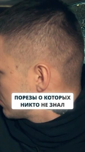 Vlad Cherevatiy Instagram - Порезы о которых никто не знал .. #экстратакси