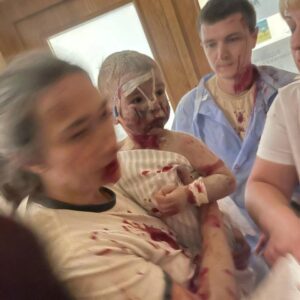 Volodymyr Shumko Instagram - По-русски, чтобы поняли все, к кому я обращаюсь. 

Я хочу, чтобы эта картинка стояла у вас перед глазами. Каждую секунду. И чтобы каждую секунду вы мысленно прижимали к себе собственного ребёнка, который привязан к капельнице. Чтобы в ушах у вас каждую секунду звучал недавний близкий взрыв. Чтобы вы судорожно понимали, что вот то бесценное медицинское оборудование, которое было залогом не лечения даже - спасения вашего ребёнка - его больше нет, сгорело, погибло под завалами. Чтобы не было слёз, один сухой ужас, каждую секунду. У каждого из вас. Каждую секунду. Каждую секунду, когда вы ходите на выставки в Манеж, едете в пушгоры, лепите из глины и думаете о том, как бы удачнее пошутить смешную шутку о том, какой занятный у вашего десятилетки предмет в школе - что-то про основы православия и патриотизма, обхохочешься. Чтобы каждую секунду, когда вам хочется почувствовать себя живым человеком, сознание возвращало вас в эту картину. 
Долго-долго. 
Целую вечность. 
А потом чтобы вы исчезли.

(c) Ірина Коротич