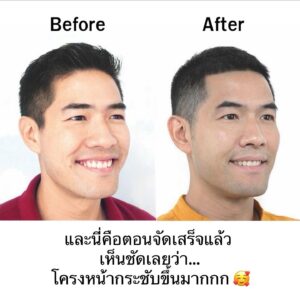 Vuthithorn Milintachinda Instagram - ทุกคนต้องดูนี่ครับว่า วด. ผ่านอะไรมาบ้าง 🥲