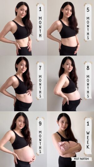 Natalia Ng Instagram - 2nd time round ✌🏻100% happier to no longer be pregnant 😂

I will say tho, this time round, my labour experience was a 180 flip! 

Instead of going into labour unexpectedly during my first pregnancy when my water broke at 35weeks  with a 16-hr labour and 30-min of pushing, my baby girl was very cozy in my belly all the way up to 39weeks  😅 So much so my OB had to manually break my water and have me induced to kickstart labour of which lasted 5–hrs with only 15-min of pushing! 

I was also smarter this time round and requested for my epidural ahead of time— positive side; couldn’t feel ANY pain 😌 negative side; puked from nausea 5x 🤮 (a common side effect of epidurals) buttttt I’ll take hangover pukes > labour pains any day 😬

So grateful to have birthed a healthy baby girlie and crazy thankful for the support of my hubby, my family, friends & community of mummies who are my much needed support system during this very sensitive postpartum recovery period ❤️‍🩹

Overall, I genuinely had a relatively positive birth experience and as I post this, I’m in the thick of confinement and excited to share my amazing confinement experience as well! So stay tuned for that 😍

#NATpreggers #secondpregnancy