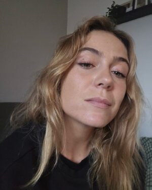 Ana Marta Ferreira Instagram - Sinceramente? Nunca pensei que este dia chegasse!
Toda a minha vida tive acne. Já tive várias fases. Com mais acne no inverno, menos no verão, mas NUNCA sem acne totalmente.

Até que um dia, recomendaram-me o @dr.luis_uva (obrigada @ana.rebelo_ e @ricardo.carrico_oficial)... e não é que finalmente encontrei o melhor?

Com a medicação certa para mim e os tratamentos adequados ao meu problema, passados uns meses estava assim: sem acne!!!! 🥹🥹🥹

Obrigada Dr. e a toda a equipa incrível que me tem acompanhado e tratado de mim ❤️ Nunca pensei um dia sentir-me melhor sem maquilhagem do que maquilhada!!!

Obrigada!!!