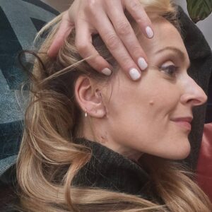 Fearne Cotton Instagram - The human body is incredible. In less than three weeks you can barely notice where I had the tumour removed. I feel almost normal. My ear is still quite numb and my face a little tender but other than that I'm feeling good. 
Only swipe if you want to see the gradual stages of healing. It's not massively gruesome but it certainly looks worse than photo number 1. I found the whole process fascinating and feel very grateful that the operation went well and that the tumour was benign. My surgeon Professor Oflynn made me feel extremely calm and all the nurses were complete angels. Nurse Jackie was especially amazing whilst I was in hospital telling me to get off my phone and nap etc. I needed a firm telling off at times. 🤣
Feeling grateful that I'm healing well and will always wear this scar with pride. A reminder to slow down and look after myself.