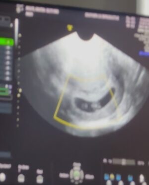 Kristen Doute Instagram - so thankful 🤎

*as a new mom-to-be, after experiencing a loss there is a lot of fear that comes with the good news. every week, and every ultrasound, lifted that weight little by little. when i saw the baby move for the first time, i finally felt like i was allowed to be excited. i am forever grateful. 🌈✨*