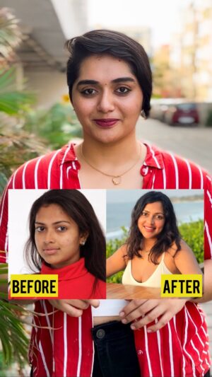 Aishwarya Murali Instagram - Want to shine like never before? ✨

Get your OUTSHINE on with Chicnutrix Outshine Korean Face Serum. 

The ultimate power of 5 serum's in one bottle, specially formulated for Indian skin.

This powerful blend helps fade dark spots, even out skin tone, and give you a radiant, glass-skin glow.

Available on Amazon, Flipkart, Nykaa, and more!

Comment SHINE to get the product link in your DM!

Visit www.chicnutrix.com and use my code “AISH” for an exclusive discount! 💜

#skincareproducts #skinhealth #skinwhitening #glutathione #chicnutrix #skincareroutines #antioxidants #explorepages #explorepage✨ #explorefeed #pixiecut #shorthairgirl #wishlinked