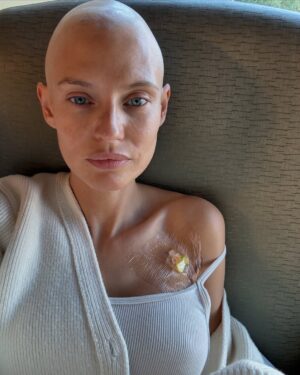 Bianca Balti Instagram - February 4th. World Cancer Day.

It has always been just a random day that some posts on Instagram reminded me of. Although my aunt died of metastatic breast cancer at age 39 and my mom got myeloma a couple of years ago. And despite my own diagnosis, back in 2021, of carrying the BRCA1 gene for which, in December 2022, I underwent a preventative double mastectomy. 
Cancer couldn’t inhabit my thoughts, let alone my body.

Until September 8th of 2024, the day that Cancer, Ovarian to be specific, came into my life feeling a whole lot like a death sentence. On October 14th, I started my chemotherapy journey that just ended last Monday, January 27th, but to my great surprise, those last few months, I felt as alive as ever. 
I was not taking my life for granted anymore, and my gratitude hit an all-time peak. Everything started to taste like a real blessing. 
It has been hard, and it isn’t quite over yet, but I wouldn’t have it any other way. They say, “What doesn’t kill you makes you stronger,” but my experience is that what didn’t kill me made me love life a lot more. 

1. October 14th, 2024, Providence St Joseph Hospital. LA. First Chemo infusion. 
2. Me, high on Benadryl (one of the meds given before treatment to prevent an allergic reaction). LOL. 
3. My love selflessly carrying me through the pain with his unconditional love.
4. Matilde shaving my head on Halloween night. I thought that I could take advantage of the occasion to dress up as Uncle Fester. Little did I know that my little pubic hair razor would take hours. LOL. 
5. November 4th, 2024, Providence St Joseph Hospital, LA. Second Chemo infusion. 
6. Filming “Le Iene” with Nic in LA (You’ve been a bit of a pain in the ass, but you did a great job at the end. Thank you, bro :)

[follows in the comments]