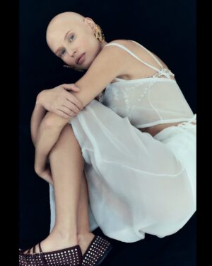 Bianca Balti Instagram - Turning Heads. 01

When I was diagnosed with cancer, I somehow knew that I would make it through, but I worried a lot about not being able to provide for my family anymore. My professional worth has always been intrinsic to my looks, and with a long scar drawing down my stomach and no hair, I don’t embody the model stereotype rn. 
Being forced into bedrest made me also realize that I heavily associate my self-esteem with productivity (IYKYK). 
Long story short, I called up my incredible team and voiced my need to feel ‘normal’ again through work. They listened and enthusiastically embraced this project.
“Turning Heads” is a labor of love that means so much to me. It expresses the support of not only my established team coordinated by my amazing manager @martinagrbgnt, but also the incredible designers and talented photographers involved. 
Lucrezia’s intimate glaze elegantly explores the delicate balance between ethereal and bold that so well defines this ephemeral moment of my life. 

PHOTOGRAPHER @lucreziaganazzoli 
STYLIST @simonrutigliano 
MAKE UP ARTIST @bianca__marzocchi 

@circustudios