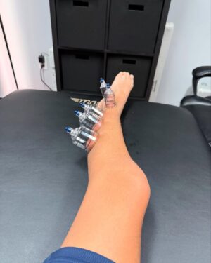 Jacqueline Bracamontes Instagram - Para todos los que preguntan cómo está mi Carito de su tobillo, ya va mucho mejor!!! Pero no ha sido nada fácil el camino de recuperación… han sido 4 semanas intensas de mucho trabajo, sacrificio y dedicación!!! Y lo que falta…. 😅😅😅 Pero siempre hay luz al final del camino… existe la posibilidad que regrese a competir a la gimnasia la próxima semana! 🤞🏻🤞🏻🤞🏻 @mft07