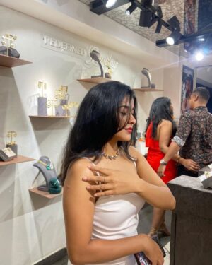 Joeann John Instagram - Guess where the mosquito decided to leave its mark. Swipe left to see the bite! 😬