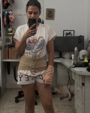 Ridergirl Vishakha Instagram - Gayab hu from social media because It’s been very painful 50 days and recovering will take a month more. Your girl is suffering from a lot of injuries and complications. 

3 slip disc and disc bulge, lumbar spine is damaged, L1 L2 L3 L4 L5  S1 knee  ligament tear , wrist ligament tear, synovial fluid in wrist, Kidney is swollen. 

Multiple MRIs Ct scans X-rays, blood test to aise kar rahe hai jaise free me khoon milta hai.
And all this because of NO accident but extreme riding.

All my doctors said 3 months rest and no travel no vlog.

I am trying to motivate myself everyday but all this is so frustrating and every little thing make me super angry and hyper. And i have been avoiding everyone i know lately.

Trying my best to be calm and smile.
Do keep me and my family in your prayers🙏