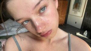 Ever Anderson Instagram - been getting lots of questions about my skincare routine because my skin is “super clear”- and thought it would be good to remind everyone that some things on social media are fake. i just woke up this morning with a period breakout even though my skincare is great, i break out from stress and eating junk so yeahhh, i post pics of me at times when im not broken out but that doesn’t mean it doesn’t happen xxx