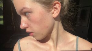 Ever Anderson Instagram - been getting lots of questions about my skincare routine because my skin is “super clear”- and thought it would be good to remind everyone that some things on social media are fake. i just woke up this morning with a period breakout even though my skincare is great, i break out from stress and eating junk so yeahhh, i post pics of me at times when im not broken out but that doesn’t mean it doesn’t happen xxx