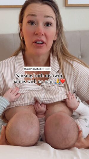 Jamie Otis Instagram - Mastitis & tongue tie release update: I’m finally feeling SO MUCH BETTER!🙏❤️ I may not look good (the babies were up ALL NIGHT on and off😴), but I FEEL good!🤪🤣

My lactation consultant told me I have raynauds & mammary constriction - which makes sense bc sometimes I’m still in a bit of pain (nothing compared to what it was)! I think I may have permanent nipple damage on my left side bc it’s just always a bit tender.🤦🏼‍♀️

I definitely had a fungal infection that just wouldn’t leave! Huxley was the only baby I fed from my left side bc Hawkins ties made it hurt so bad on that side. Hawkins hasn’t had a diaper rash but Huxley has had one that also won’t leave. I believe I gave him the fungal infection.😩 Oddly, the culture didn’t pick up on it though?!🤷🏼‍♀️

I know the silverette cups are all the rage right now, but be careful using them. I used them consistently bc my nips were in so much pain. My milk would leak out & sit on my nipple without me realizing it. 

Fungus thrives in dark, moist, warm areas so I genuinely think that is what contributed to my infection.

I know the silverettes are technically anti fungal but nothing cleared my infection other than keeping my nipples DRY as much as possible.🙏🙏🙏

I’m sharing my journey in hopes it helps even just one mom not have to go through this bc it was BRUTAL.🥴

I really believe in the power of mothers sharing our stories and journeys in order to help each other out! Motherhood is hard and we shouldn’t have to go through it alone!🙏💕

Curious if anyone else had a similar experience with the silverettes? I honestly loved that they shielded my cracked nips from pain, but I genuinely believe you gotta check and make sure your milk isn’t leaking and just sitting there consistently bc it can breed infection.💯❤️

Feels SO GOOD to finally be on the other side of this!🙏❤️👏

#momminainteasy #breastfeedingmom #breastfeedingjourney #postpartum #postpartumjourney #mastitis