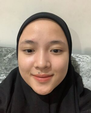 Nissa Sabyan Instagram - sebelum dan sesudah treatment di klinik @dermaster_id 😍🫶✨

perjalanan Acne ku😊
slide 1-3 itu tanggal 1 juli 2024 foto muka ku yg lg breakout karna gak cocok pakai makeup😭😭😭 dan aku lgsng buru2 treatment ke @dermaster_id 
slide 4-7 itu tanggal 3 agustus 2024 setelah aku treatment di @dermaster_id Alhamdulillah jerawat ku sembuh gessss😭🤲🤗

Thank u @dermaster_id Dokter @dr.sallienaomi and kaka ku sayang @tivanirahmagumay 
please kalian wajib bgt kesana. 10/10⭐️