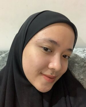 Nissa Sabyan Instagram - sebelum dan sesudah treatment di klinik @dermaster_id 😍🫶✨

perjalanan Acne ku😊
slide 1-3 itu tanggal 1 juli 2024 foto muka ku yg lg breakout karna gak cocok pakai makeup😭😭😭 dan aku lgsng buru2 treatment ke @dermaster_id 
slide 4-7 itu tanggal 3 agustus 2024 setelah aku treatment di @dermaster_id Alhamdulillah jerawat ku sembuh gessss😭🤲🤗

Thank u @dermaster_id Dokter @dr.sallienaomi and kaka ku sayang @tivanirahmagumay 
please kalian wajib bgt kesana. 10/10⭐️