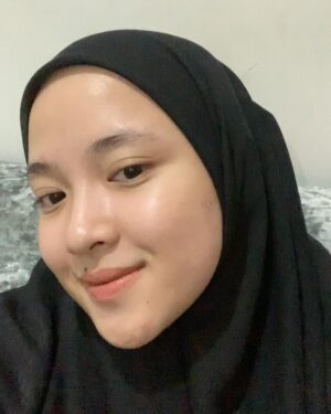 Nissa Sabyan Instagram - sebelum dan sesudah treatment di klinik @dermaster_id 😍🫶✨

perjalanan Acne ku😊
slide 1-3 itu tanggal 1 juli 2024 foto muka ku yg lg breakout karna gak cocok pakai makeup😭😭😭 dan aku lgsng buru2 treatment ke @dermaster_id 
slide 4-7 itu tanggal 3 agustus 2024 setelah aku treatment di @dermaster_id Alhamdulillah jerawat ku sembuh gessss😭🤲🤗

Thank u @dermaster_id Dokter @dr.sallienaomi and kaka ku sayang @tivanirahmagumay 
please kalian wajib bgt kesana. 10/10⭐️