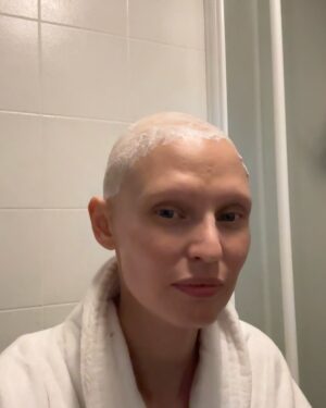 Bianca Balti Instagram - The craziest month of my life 💘 
Crazy good (not crazy bad). As good as only the first month after chemotherapy might feel. My hair are growing back and life is giving 🫶🏼