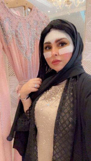Zainab Al Askari Instagram - كشخة العيد هالسنه غير 😅😅😅رغم التورم اللي في ويهي من منظار لرفع الحاجب وشد اللغلوغ ورغم ان عيدي كان عتاب من  الجميع لي 🫣🫣بس ماقدرت مااحتفل مع الغالين انتظروا  النتيجة قريبا لاتخافون تعديل بسيط مابيغير ملامحي🤗🤗🤗