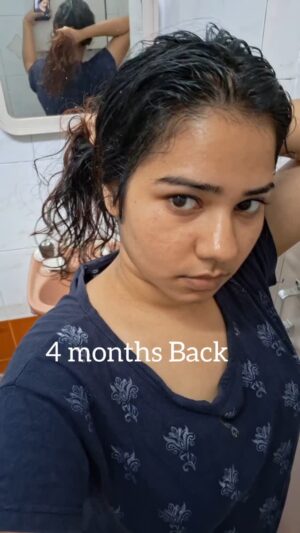 srimathi chimu Instagram - The only thing that Fell for me in 2024 is my hair😂
My hair care journey in 90 seconds💓

Do use Wishcare Hair Growth Serum consistently and tell me how it worked for u too in comments ❤️💁‍♀️ #HairCare #WishcareHairGrowth #HairGrowth #Beauty @mywishcare